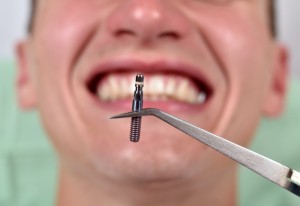 protesis o implante dental