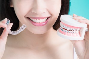 higiene dental según tipos de ortodoncia